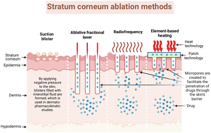 Graphical abstract: Enhancement of drug permeation across skin through stratum corneum ablation