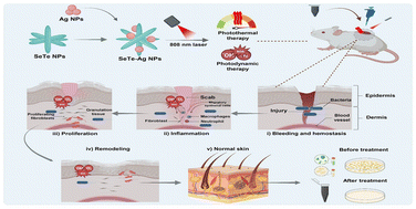 Graphical abstract: Silver incorporated SeTe nanoparticles with enhanced photothermal and photodynamic properties for synergistic effects on anti-bacterial activity and wound healing