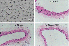 Graphical abstract: CoS1.097 nanocrystals as new nanoplatforms for photothermal therapy of arterial inflammation