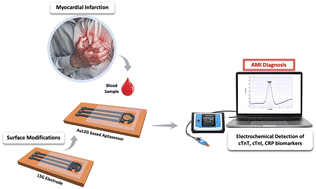 Graphical abstract: Multiplexed aptasensor for detection of acute myocardial infraction (AMI) biomarkers