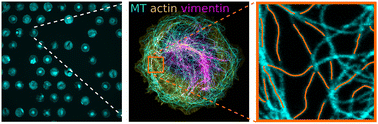 Graphical abstract: Global alignment and local curvature of microtubules in mouse fibroblasts are robust against perturbations of vimentin and actin