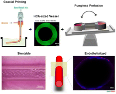 Graphical abstract: Coaxial bioprinting of a stentable and endothelialized human coronary artery-sized in vitro model