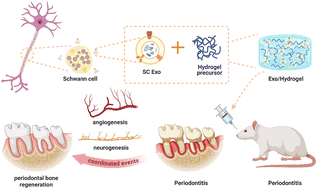 Graphical abstract: Schwann cell-derived exosomes accelerate periodontal bone regeneration with osteogenesis, angiogenesis, and neurogenesis