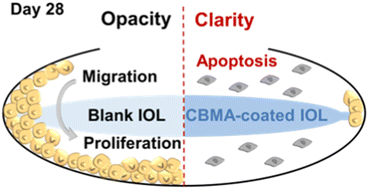 Graphical abstract: Surface modification of intraocular lenses with zwitterionic poly(carboxybetaine) for posterior capsular opacification prevention