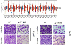 Graphical abstract: Comprehensive multi-omics analysis and experimental validation indicate that VPS35 is a promising biomarker for prognosis, immunotherapy, and chemotherapy in LIHC