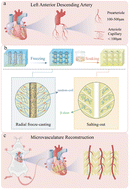 Graphical abstract: Perfusable and toughening cardiac patch with hierarchically branched microchannels for myocardial infarction revascularization