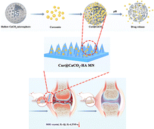 Graphical abstract: pH-responsive microneedle patches for effective treatment of acute gouty arthritis