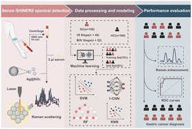 Graphical abstract: A machine learning-enhanced gastric cancer diagnostic method based on shell-isolated nanoparticle-enhanced Raman spectroscopy