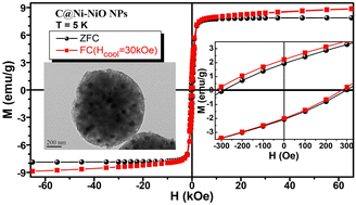 Graphical abstract: Microstructures and anomalous magnetic properties of C@Ni–NiO nanoparticles synthesized by a homogeneous precipitation method