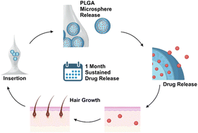 Graphical abstract: Patient-convenient long-term alopecia treatment via PLGA microsphere-loaded candlelit microneedles