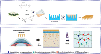 Graphical abstract: A dissolving microneedle patch enables minimally invasive riboflavin delivery and enhances corneal crosslinking in keratoconus therapy