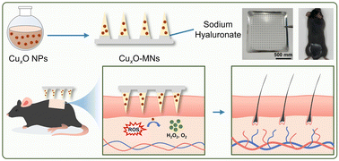 Graphical abstract: A ROS-scavenging CuxO nanozyme-functionalized microneedle patch for androgenetic alopecia treatment