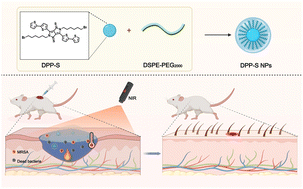 Graphical abstract: Near infrared-triggered diketopyrrolopyrrole nanoparticles for photothermal applications against bacterial infections