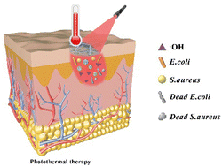Graphical abstract: Bimetal phenolic network-based alginate cryogels for rapid hemostasis and photothermal enhanced bimetallic chemodynamic therapy for wound infection