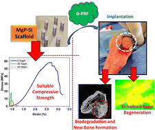 Graphical abstract: Decellularized-PRF and multiscale porosity in Si-doped MgP scaffolds: a strategy for enhanced bone regeneration