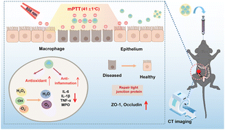 Graphical abstract: Au@CeO2 nanozyme–based targeted delivery platform for computed tomography–guided synergistic antioxidant/mild photothermal therapy of inflammatory bowel disease