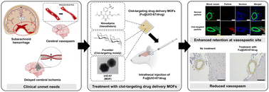 Graphical abstract: Fucoidan-coated metal–organic framework nanoparticles for targeted delivery of nimodipine in subarachnoid hemorrhage-induced vasospasm