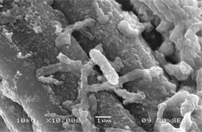 Graphical abstract: A novel biomonitoring system using microbial fuel cells