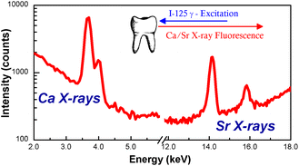 Graphical abstract: The use of teeth as the site for the in vivo or ex vivo quantification of skeletal strontium by energy-dispersive X-ray fluorescence spectrometry: A feasibility study
