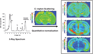 Graphical abstract: Quantitative imaging of element spatial distribution in the brain section of a mouse model of Alzheimer's disease using synchrotron radiation X-ray fluorescence analysis