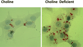 Graphical abstract: The impact of choline availability on muscle lipid metabolism
