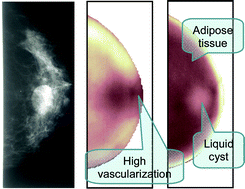 Graphical abstract: Diffuse optical imaging and spectroscopy of the breast: A brief outline of history and perspectives
