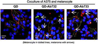 Graphical abstract: Detection of melanoma using antibody-conjugated quantum dots in a coculture model for high-throughput screening system