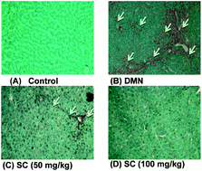 Graphical abstract: Phyto-power dietary supplement potently inhibits dimethylnitrosamine-induced liver fibrosis in rats