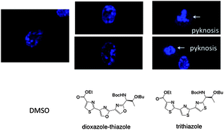 Graphical abstract: A structure–activity relationship study on multi-heterocyclic molecules: two linked thiazoles are required for cytotoxic activity