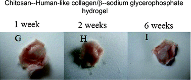 Graphical abstract: New suitable for tissue reconstruction injectable chitosan/collagen-based hydrogels