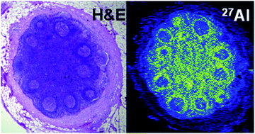 Graphical abstract: Elemental bioimaging of haematoxylin and eosin-stained tissues by laser ablation ICP-MS