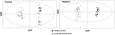 Graphical abstract: Exploratory investigation of plasma metabolomics in human lung adenocarcinoma