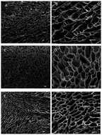 Graphical abstract: Preparation of a soft and interconnected macroporous hydroxypropyl cellulose methacrylate scaffold for adipose tissue engineering