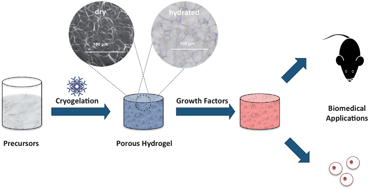 Graphical abstract: Cryogels for biomedical applications
