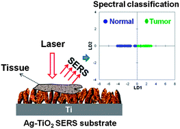 Graphical abstract: Rapid detection of oral cancer using Ag–TiO2 nanostructured surface-enhanced Raman spectroscopic substrates