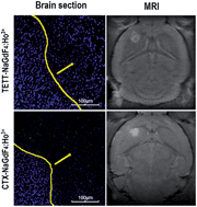 Graphical abstract: Ho3+ doped NaGdF4 nanoparticles as MRI/optical probes for brain glioma imaging