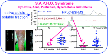 Graphical abstract: The salivary proteome profile in patients affected by SAPHO syndrome characterized by a top-down RP-HPLC-ESI-MS platform