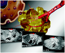 Graphical abstract: Highly sensitive MRI contrast agent for enhanced visualization of tumors