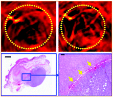 Graphical abstract: Theranostic probe for simultaneous in vivo photoacoustic imaging and confined photothermolysis by pulsed laser at 1064 nm in 4T1 breast cancer model