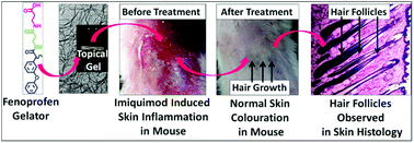 Graphical abstract: A supramolecular topical gel derived from a non-steroidal anti-inflammatory drug, fenoprofen, is capable of treating skin inflammation in mice