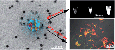 Graphical abstract: Theranostic nanoscale coordination polymers for magnetic resonance imaging and bisphosphonate delivery