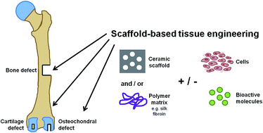 Graphical abstract: Scaffold-based regeneration of skeletal tissues to meet clinical challenges