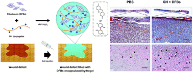 Graphical abstract: Enzyme-catalyzed in situ forming gelatin hydrogels as bioactive wound dressings: effects of fibroblast delivery on wound healing efficacy