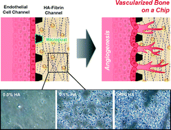 Graphical abstract: Microfluidic vascularized bone tissue model with hydroxyapatite-incorporated extracellular matrix