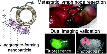Graphical abstract: Stable J-aggregation enabled dual photoacoustic and fluorescence nanoparticles for intraoperative cancer imaging