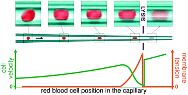 Graphical abstract: Pressure-driven occlusive flow of a confined red blood cell