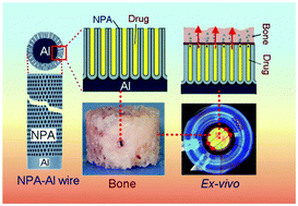 Graphical abstract: Nanoengineered drug releasing aluminium wire implants: a model study for localized bone therapy