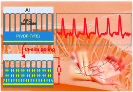 Graphical abstract: Self-powered flexible pressure sensors with vertically well-aligned piezoelectric nanowire arrays for monitoring vital signs