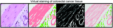 Graphical abstract: Virtual staining of colon cancer tissue by label-free Raman micro-spectroscopy