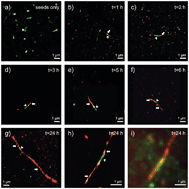 Graphical abstract: Super-resolution imaging of alpha-synuclein polymorphisms and their potential role in neurodegeneration